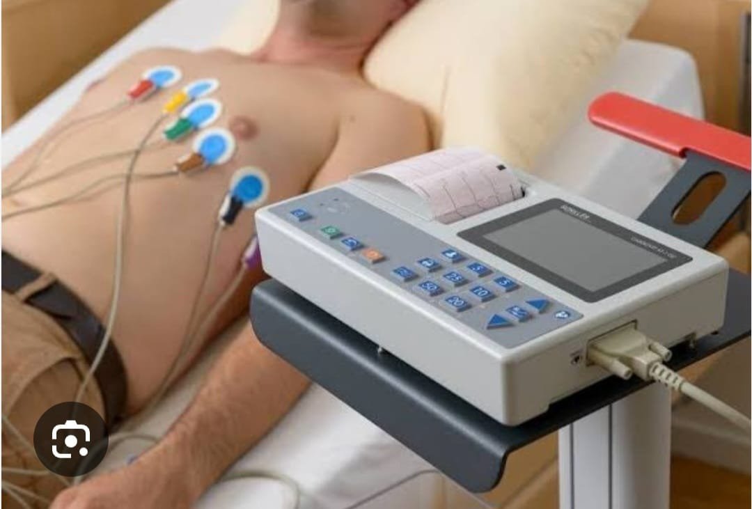 ECG